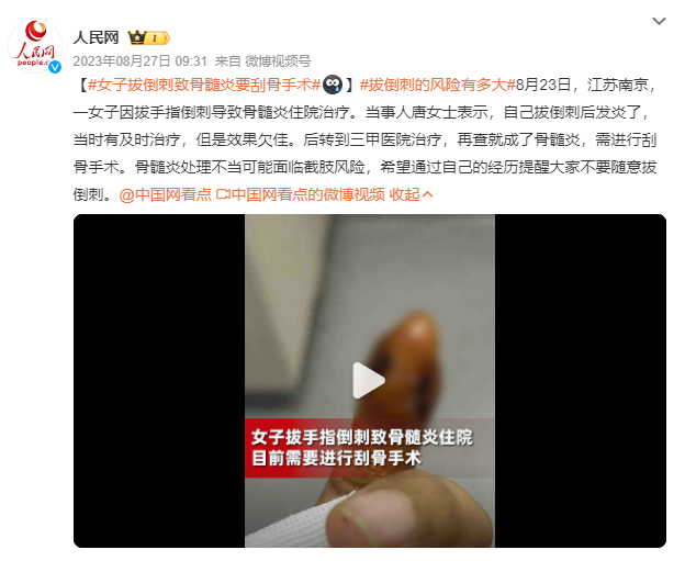 https://img.xiumi.us/xmi/ua/4hmg7/i/a16f7c4d3ce3ec08578d77f5ae38a8f3-sz_145483.png