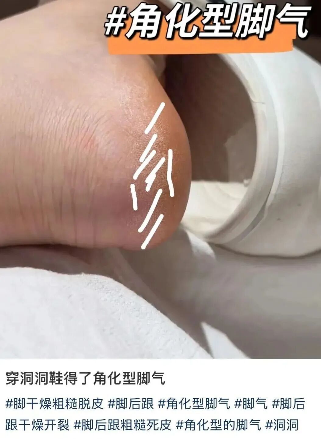 17351986369298.jpeg 图片